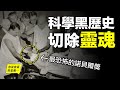 科學黑歷史：切除腦子的手術，竟然還得過諾貝爾獎……|自說自話的總裁