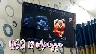 Ada Kejutan tak Terduga di USG kehamilan 17 Minggu