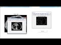 Biomedical Image Processing Projects & Thesis