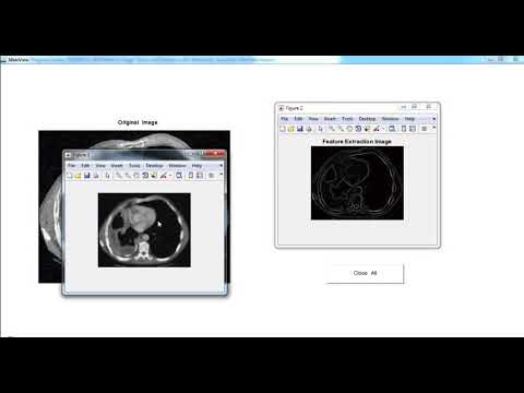 Biomedical Image Processing Projects | Biomedical Image Processing Thesis
