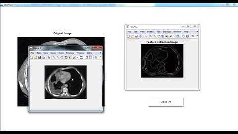 Biomedical Image Processing Projects | Biomedical Image Processing Thesis