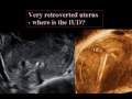 What’s New in 3D Ultrasound of the Pelvis