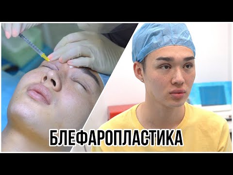 МЕНЯЮ ВНЕШНОСТЬ: МОЯ ПЕРВАЯ ОПЕРАЦИЯ / АДИЛЬ ХЭЙНС