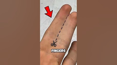 ⚠️ Als je zo wakker wordt... raak dan niet in paniek‼️😨