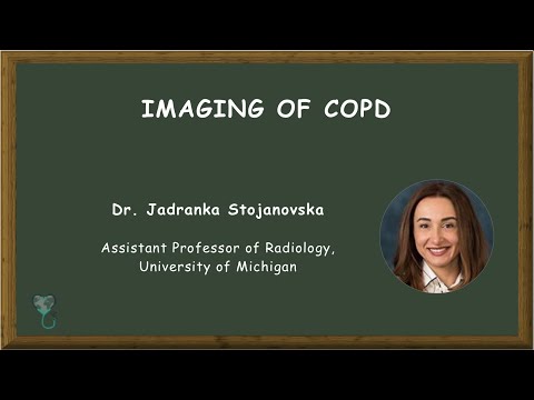 Video: 29 Henkilöä, Jotka Elävät COPD: N Kanssa, Jakavat Inspiroivia Tarinoita