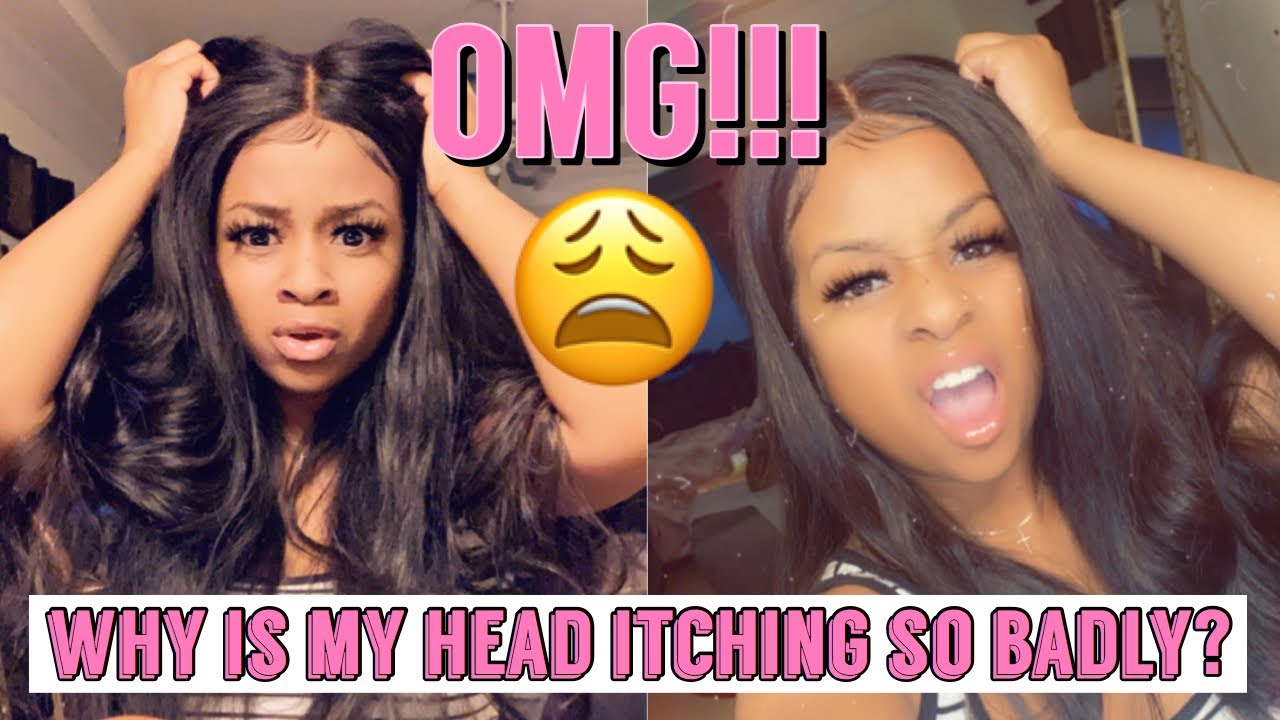How To: Prevent/ Get Your Sew In From Itching Using Natural Ingredients |  **MUST WATCH** 🤫| - YouTube