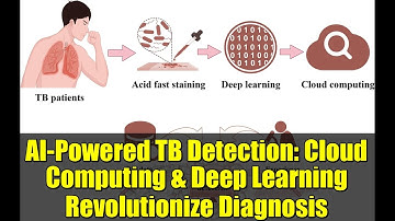 AI-Powered TB Detection: Cloud Computing & Deep Learning Revolutionize Diagnosis
