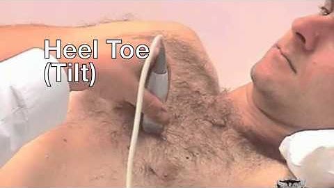 Ultrasound Transducer Movements