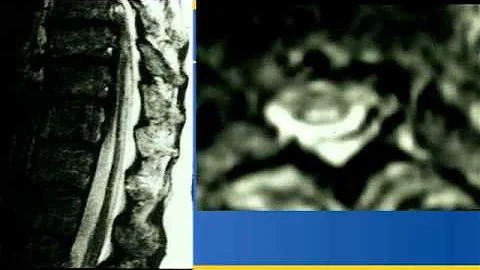 e-Radiology Learning | Neuroradiology Pearls and Pitfalls (2 of 4)