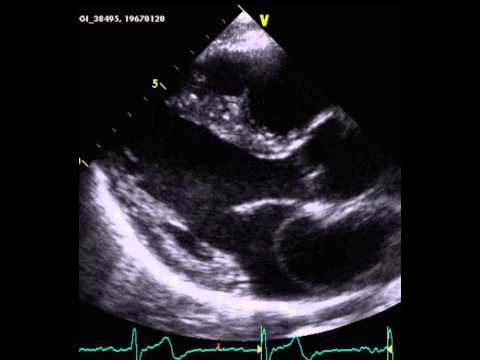 Echocardiography Tutorial