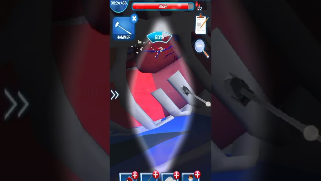 surgery master level 4