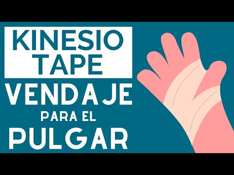 vendaje neuromuscular para tendinitis de quervain vendaje neuromuscular para tendinitis de quervain