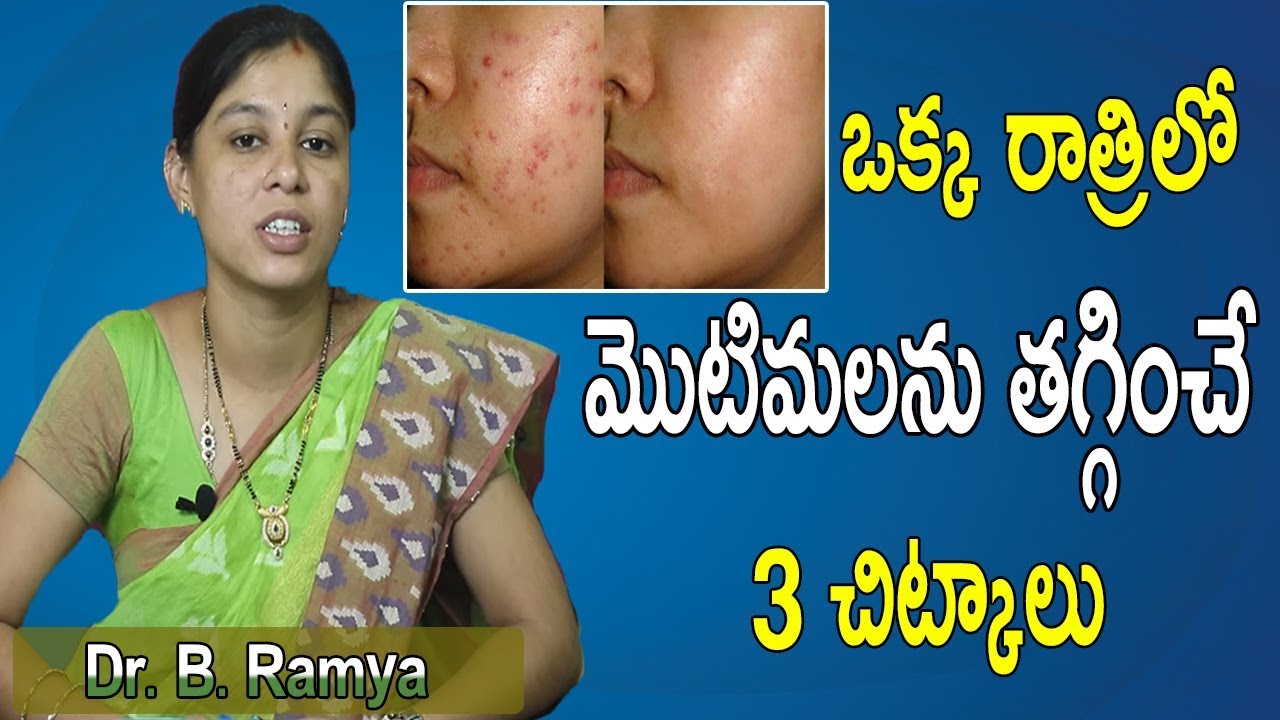 How to get rid of pimples fast in telugu Motimalu Pimples removal on face at home YouTube