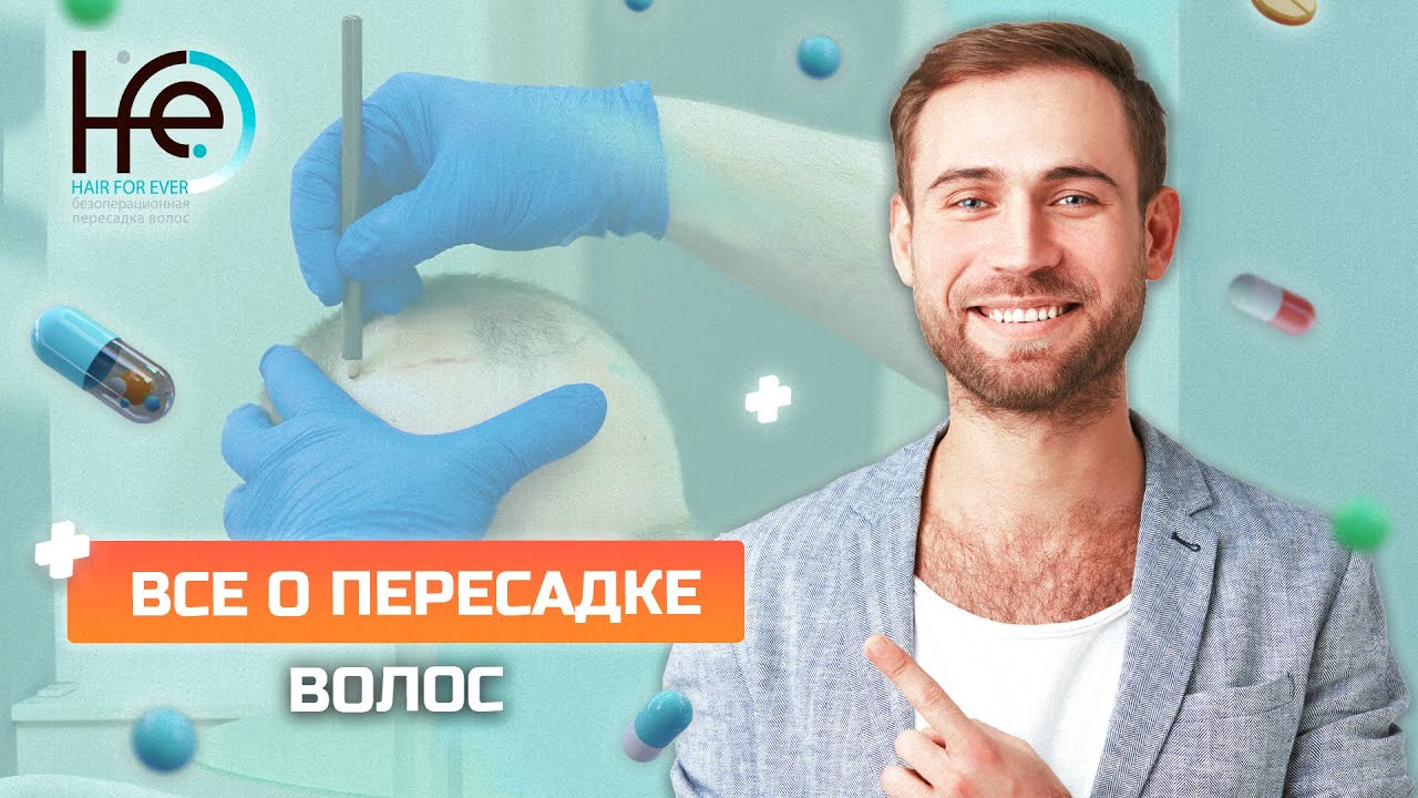 10 Вопросов О Пересадке Волос - YouTube