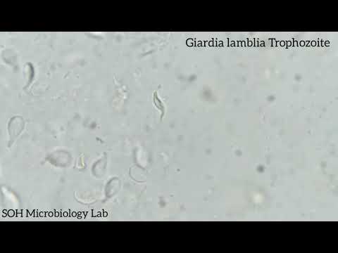 Giardia Lamblia Trophozoite In Stool