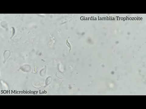 Video: Astoņi Unikāli Bazālie ķermeņi Multi-flagellated Diplomonad Giardia Lamblia