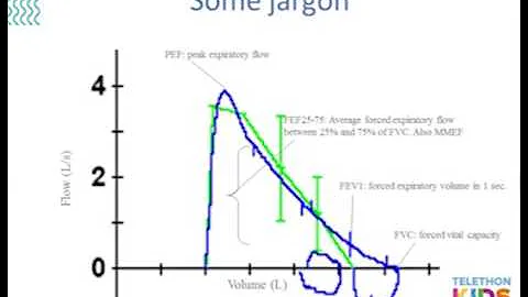 Diagnosing asthma and the role of good spirometry