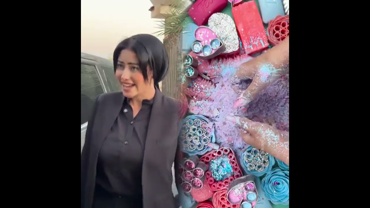 #الطفل الاعمى المعجزه #محضوره_من_الاكسبلور_والمشاهدات #علاوي_مارتن #اكسبلور 15_w