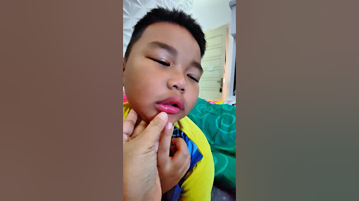 Mama Riska Vlog Takes Care of Incess Nari Rafisqy's Mouth Almost Got Injured