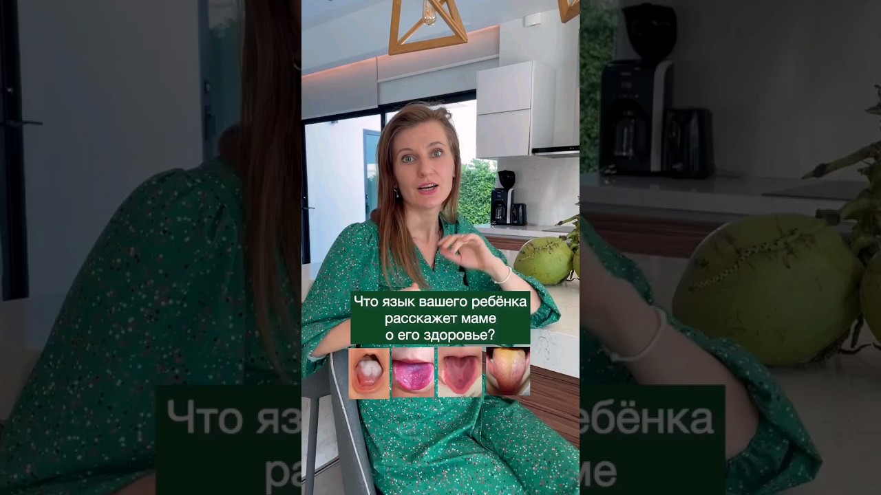 👅 Как по языку ребенка узнать о болезнях и нехватки витаминов. Белый налет на языке #нутрициолог
