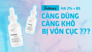 Tại Sao Dùng Hyanuronic 2% + B5 Bị Khô Da, Vón Cục | Nguyên Nhân Và Cách Khắc Phục