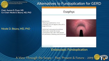 Endoscopic Fundoplication