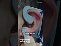 Can a small ear clip make a big impact on heart health after COVID-19?