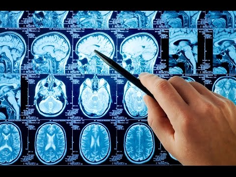 МРТ головного мозга: ответы на самые частые вопросы
