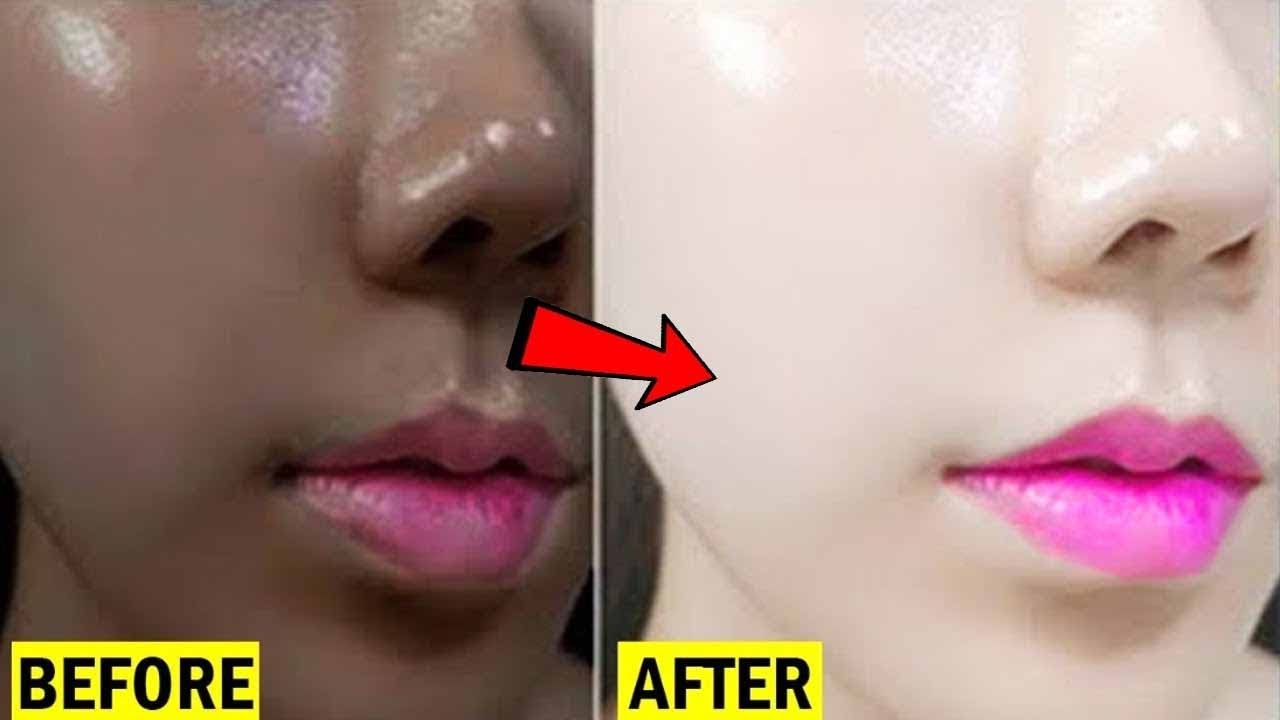 DIY SKIN BLEACHING FOR WHITENING + HOME REMEDIES // Skin Whitening Bleach YouTube