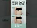 팔, 복부360 아웃핏 타이트💚 #팔뚝아웃핏 #복부아웃핏 #아웃핏주사 #아웃핏 #지방추출주사 #지방흡입#밸런스랩성형외과