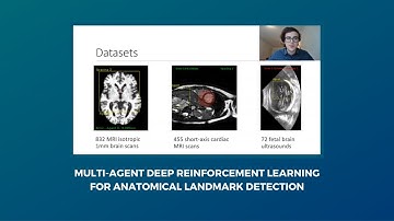 Multi-agent Deep Reinforcement Learning for Anatomical Landmark Detection - Student project