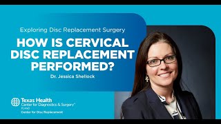 Exploring Disc Replacement Surgery: What Happens During Cervical Disc Replacement