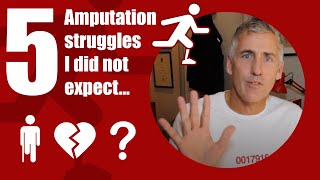 AMPUTEE - 5 Things I DID NOT EXPECT after losing my leg