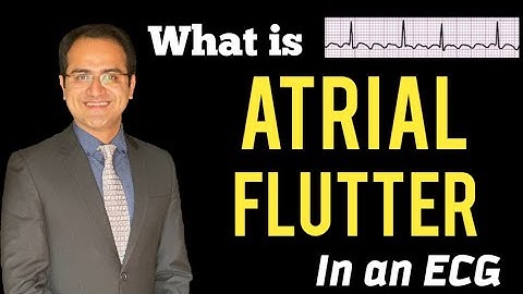 Atrial Flutter ECG Explained, Practice ECG