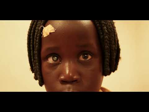 2. Yumbe Sağlık Kampı | Söz Verdik! Ugandalı Hastalar İçin Geri Dönüyoruz