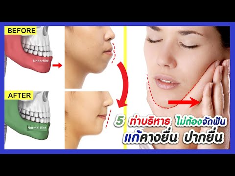 5 ท่าบริหาร แก้คางยื่น ปากยื่น (ไม่ต้องจัดฟัน) ลดริมฝีปากล่างใหญ่ | ออกกำลังกายปรับกราบ การสบฟัน