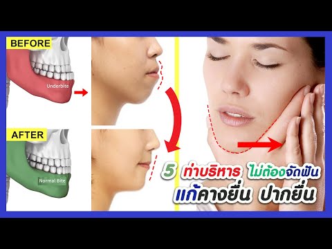 5 ท่าบริหาร แก้คางยื่น ปากยื่น (ไม่ต้องจัดฟัน) ลดริมฝีปากล่างใหญ่  | ออกกำลังกายปรับกราบ การสบฟัน