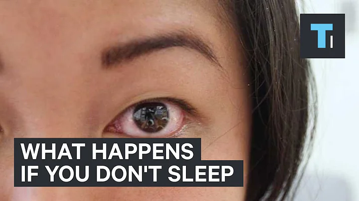 What happens if you don't sleep - DayDayNews