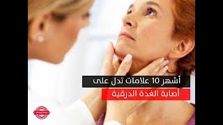 علامات الاصابة بالغدة الدرقية | أشهر 10 علامات تدل على أصابتك بالغدة الدرقية