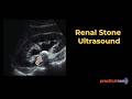 Everything You NEED to Know About Renal Stone on Ultrasound