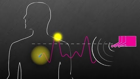 This Wireless System Can Power Devices Inside The Body
