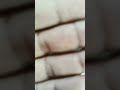 deepika behan ko insaf kab milega /deepika haytyakand ka aropi pakada gya #noida #youtube #shrots