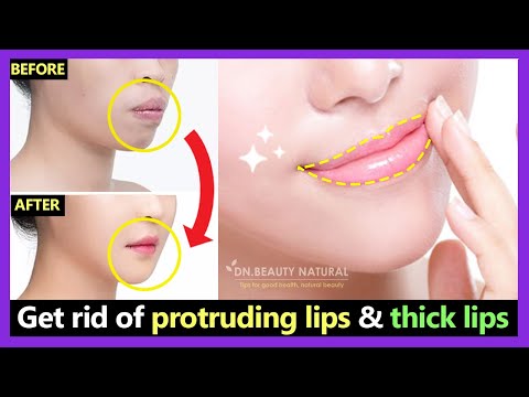 How to get rid of Protruding Mouth and Lips naturally | Make Thick lips to Thin lips with exercises.