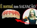 DIFICULDADE de FALAR?! Trocou de prótese e está (FALANDO ESTRANHO)? Assista este vídeo e entenda!