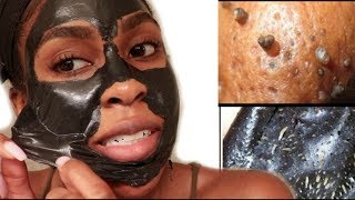 Easy Blackhead And Whitehead Remover Peel Off Mask