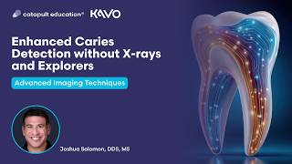 Dental Treatment: Enhanced Caries Detection Without X-rays And Explorers | Jul 23, 2026