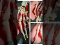 Anatomy lab  thodi si Masti
