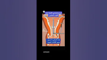 فيديو توضيحي لكيفية عمل اللولب النحاسي داخل الرحم 
