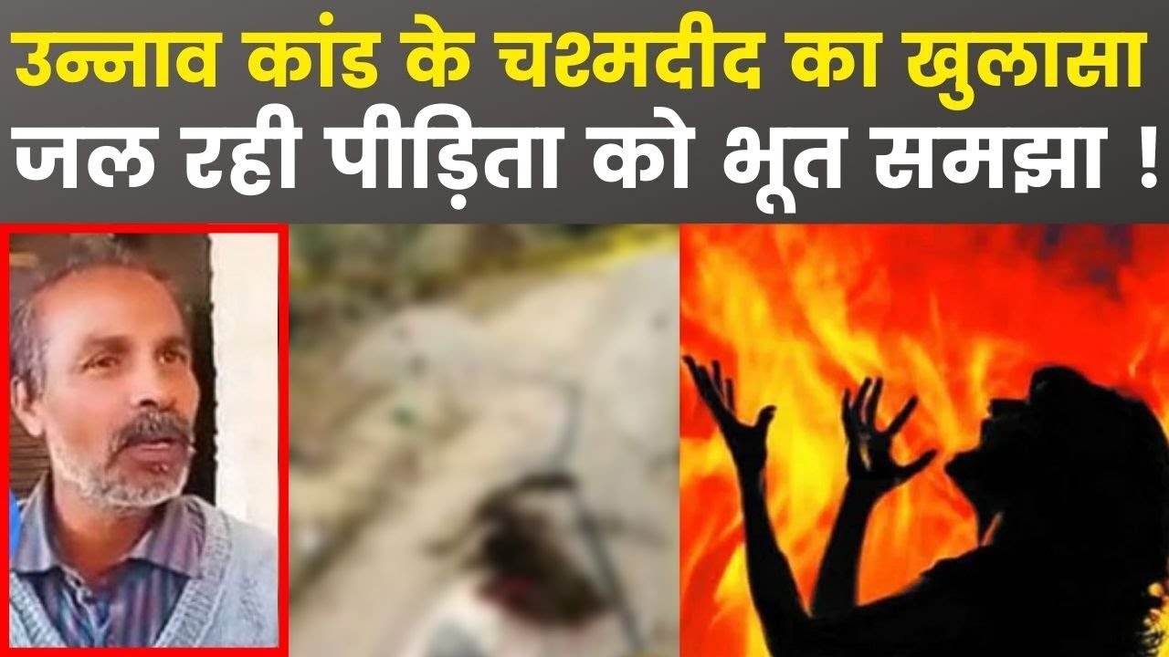 Unnao Rape Victim set on fire: Eyewitness recalls horrific scene: पीड़िता को भूत समझा ! | India News Unnao Rape Victim set on fire: Eyewitness recalls horrific scene: पीड़िता को भूत समझा ! | India News