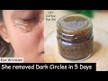i Removed DARK CIRCLES in 5 Days | Under Eye WRINKLES, Eye Bags -  Coffee Eye Mask & Coffee Eye Gel